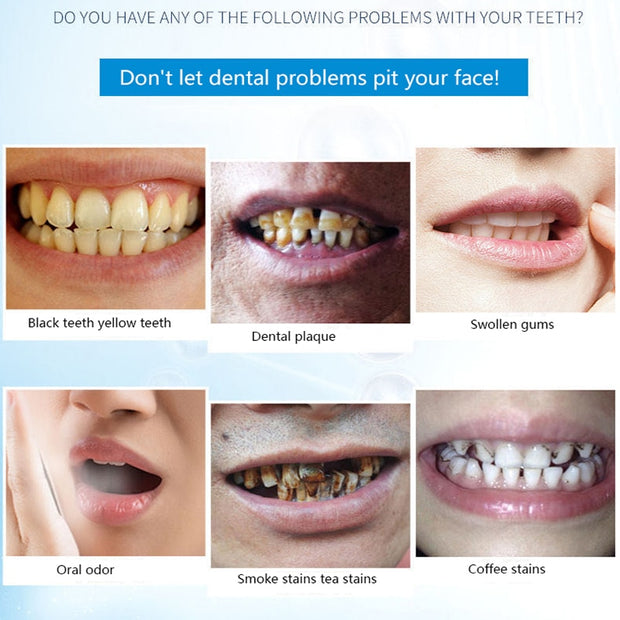 Dentifrice Teeth Whitening Powder